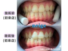 ネージュ(neige)/10代後半/女性/お茶1日3杯