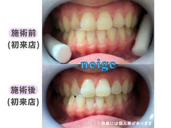 ネージュ(neige)/10代後半/女性/お茶1日3杯