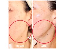 ランティル(l’until)の雰囲気（◎エイジングによるフェイスラインのたるみ/目の下の脂肪もケア）