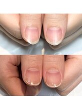 キュア(Cure.)/素爪美人になる為のメニュー