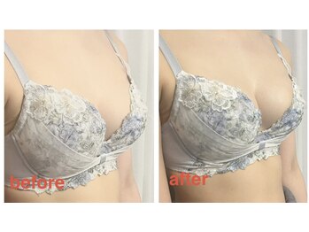 ポワトリーヌ ベル 三鷹店の写真/鏡で胸の位置がさがっている…。悲しい…。バストサロンって効果が出るか不安。そんな方にお得なコース★