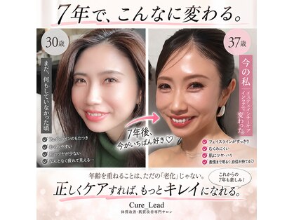 キュアリード(Cure_Lead)の写真
