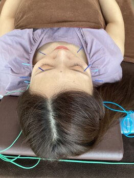 ハリファ鍼灸院 横浜関内院(HariFa鍼灸院)/美容鍼