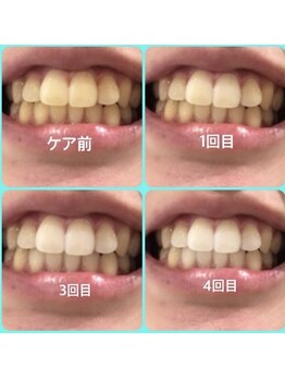 時間旅行/来店前と来店4回目の写真