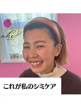 フー(Who?)/これが私のシミケア