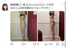 エステティック アントワネット/