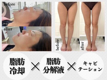 ララナ バイ カノア(LALANA by kanoa)の写真