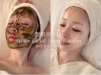 ステラ(Stella)の写真