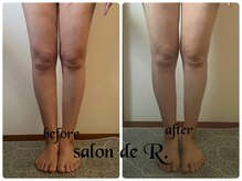 サロン ド アール(salon de R.)/【脚足骨氣・40代・施術効果】