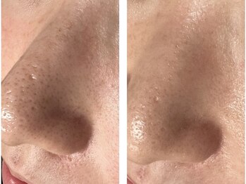 リボーン(REBORN)/毛穴もすっきり