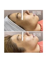 ホワイトワックス 京都四条烏丸(WHITE WAX)/水光肌★