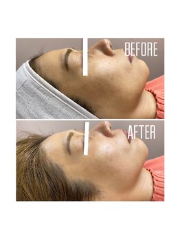 ホワイトワックス 京都四条烏丸(WHITE WAX)/水光肌★