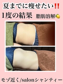 サロン シャンティー/まだ間に合う!夏までに・・・