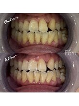 エクリュ(Ecru)/Before→After