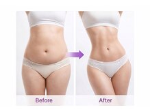 アプロ(Aphro)/ラインを整える全身スリムケア