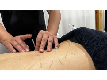 はりきゅう治療院 ガク ワンアンドオンリー(GAKU One&Only)の写真/【鍼灸初心者さん大歓迎♪】丁寧なカウンセリングで知識豊富な専門スタッフがひとりひとりのお悩みを解消◎