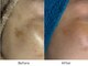トータルビューティー ココ(Total Beauty CoCo)の写真/【シミケア専門】独自の肌分析で原因を特定。諦めていたシミも根本から徹底ケア
