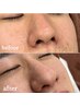 眉毛スタイリング[美眉WAX]＋小鼻洗浄＜いちご鼻・黒ずみ改善♪＞【眉毛】