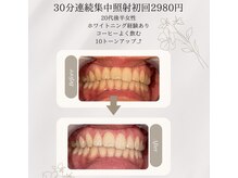 プラスビーセルフ(+b self)/ホワイトニングビフォーアフター