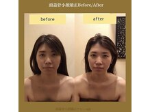 アジール 新潟市(agir)/Before/After画像