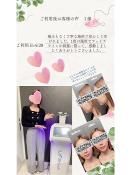 サンスタイルクリア 守山店(SUN STYLE CLEAR)/小顔リフショック利用者様のお声