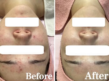 ロゼブランシュ(Rose Blanche)