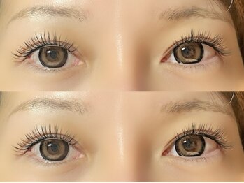 リジェネ(Regene)/LEDバインドロック100束