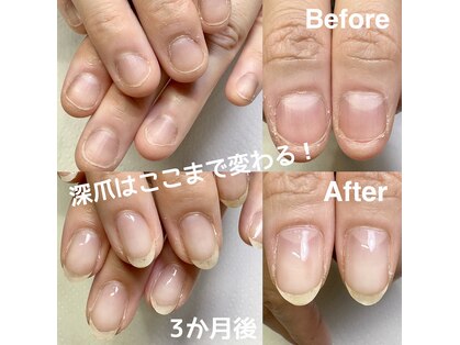 ネイルフレーバー(Nail Fravor)の写真