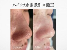 アンドミルル(and Milulu)/【ハイドラ水素吸引×艶玉】