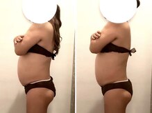 エムフルール 吹田市