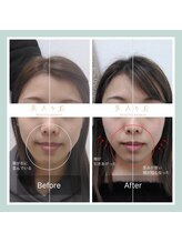 美人ヶ丘/自由が丘,小顔矯正,マッサージ