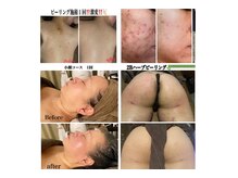 サロン ド シェリ 人形町(Salon de cheri)の雰囲気（医療提携による商材と高技術によるトリートメントで徹底改善!）