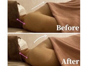 ベルフェム(Bellefemme)/施術ビフォーアフター &nbsp;