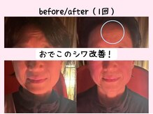 ヨサパーク ベアトリーチェ(YOSA PARK beatrice)/水素吸入×進化版よもぎ蒸し