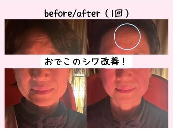 ヨサパーク ベアトリーチェ(YOSA PARK beatrice)/水素吸入×進化版よもぎ蒸し