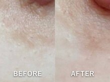 ドアディ(Doordie)/ローマピンク