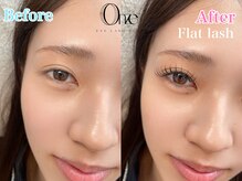 オンズ(Onze)/フラットラッシュ140★新宿