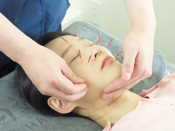 白記漢方堂鍼灸院(HAKU KI)の写真/《目の疲れ・重だるさに》頑張る自分へ極上の癒し時間を＊ツボを的確に捉える本格施術で視界クッキリ爽快◎