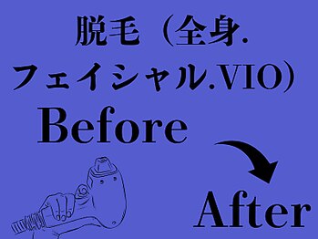 ビースキン 広島(BE:SKIN)/全身脱毛/フェイシャル/VIO