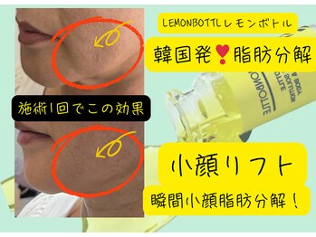 ウェリナベル(WelinaBelle)/レモンボトルフ脂肪分解液導入