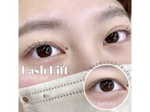 ビーティー(bT)/