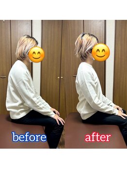 中島整体院 恵比寿本院/姿勢ビフォーアフター2
