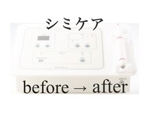 ブランシェ 高岡店 × 椿/次世代シミケア機器「REAGE」