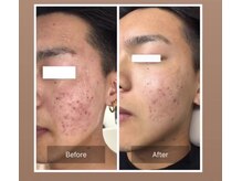 ケースタイル(k.style)/before after写真