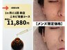 【メンズ限定】ニキビケア・肌荒れ・毛穴洗浄【4週間以内】¥14,850→¥11,880