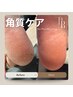 【メンズフット】ツルツル！お爪の甘皮ケア＆かかと角質除去/完璧パッケージ