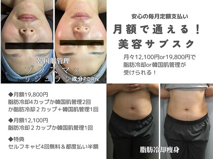 ミロク(369)の写真
