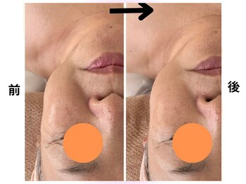 カリアンヌ/リンパマッサージ&フェイシャル