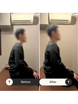 トータルボディケア整体 長居駅前店/猫背の改善！