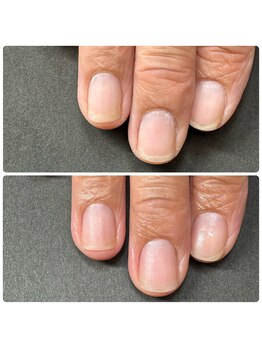 ウォーターケアで角質スッキリ